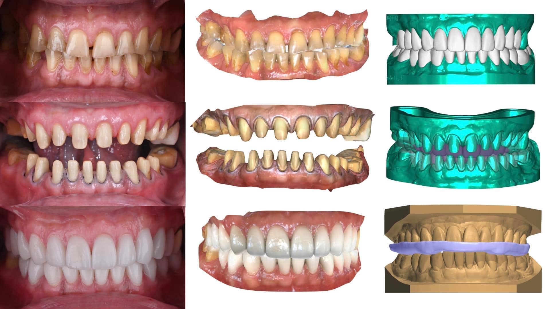 Digital Smile Design