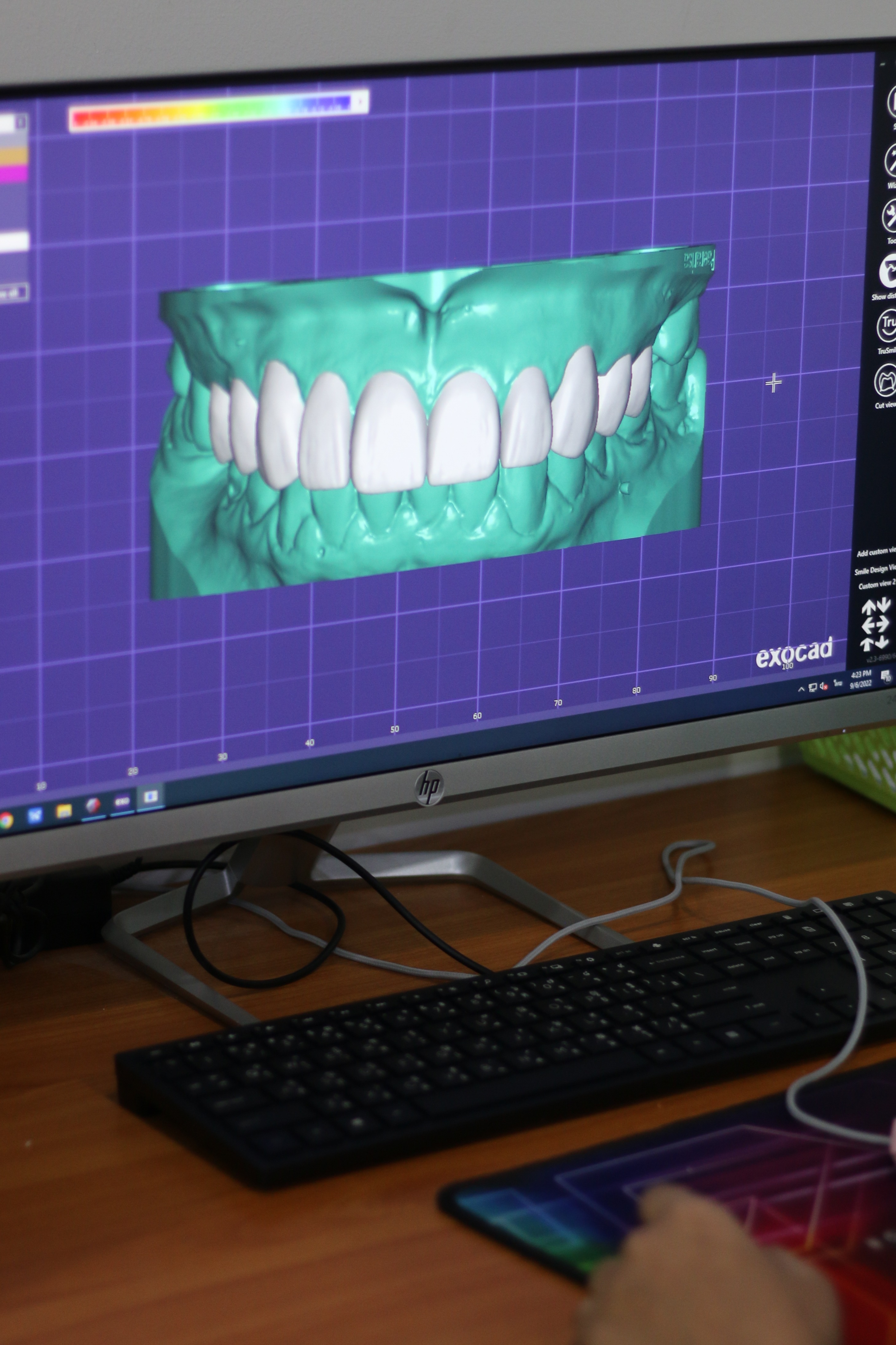 Digital Smile Design